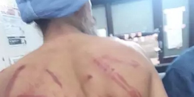 राजधानी में ग्रामीण सेवा ड्राइवर से मारपीट, MHA ने मांगी रिपोर्ट, 3 पुलिसकर्मी सस्पेंड