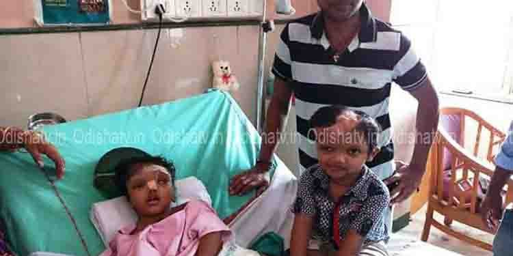 Separated Conjoined Twins Jaga, Kalia Likely To Return Odisha Soon